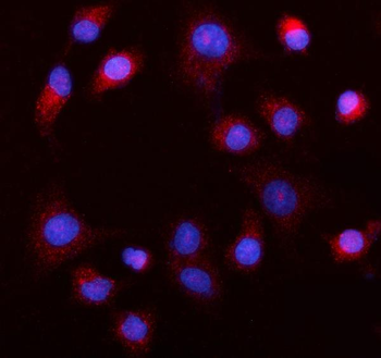 MEK5/MAP2K5 Rabbit Polyclonal Antibody
