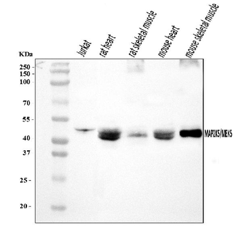 MEK5/MAP2K5 Rabbit Polyclonal Antibody