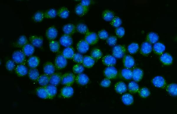 CD45/Ptprc Rabbit Polyclonal Antibody