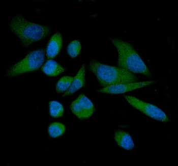 TROP2/TACSTD2 Rabbit Polyclonal Antibody