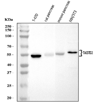 TROP2/TACSTD2 Rabbit Polyclonal Antibody