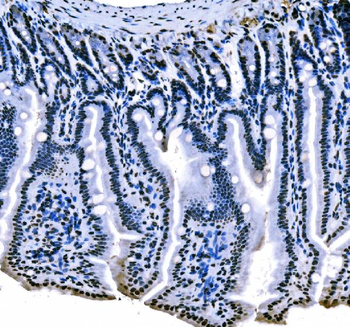 splicing factor 1 Mouse Monoclonal Antibody