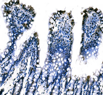 splicing factor 1 Mouse Monoclonal Antibody
