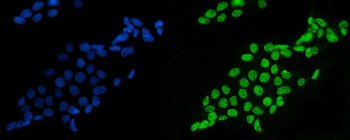 splicing factor 1 Mouse Monoclonal Antibody