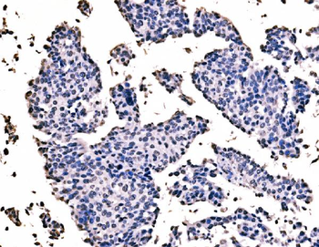 splicing factor 1 Mouse Monoclonal Antibody