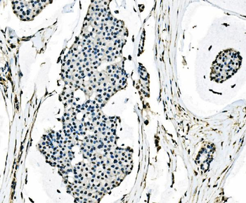 splicing factor 1 Mouse Monoclonal Antibody