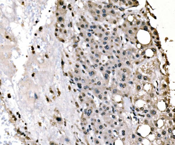 splicing factor 1 Mouse Monoclonal Antibody