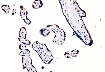splicing factor 1 Mouse Monoclonal Antibody