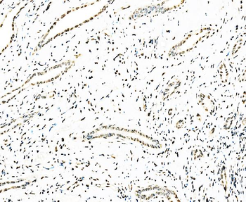 splicing factor 1 Mouse Monoclonal Antibody