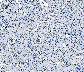splicing factor 1 Mouse Monoclonal Antibody