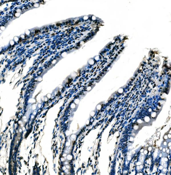 splicing factor 1 Mouse Monoclonal Antibody