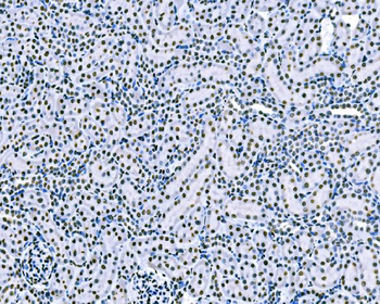 splicing factor 1 Mouse Monoclonal Antibody