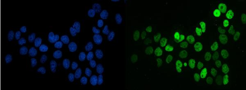 splicing factor 1 Mouse Monoclonal Antibody