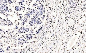 splicing factor 1 Mouse Monoclonal Antibody