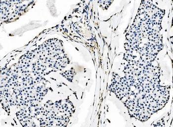 splicing factor 1 Mouse Monoclonal Antibody