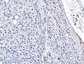 splicing factor 1 Mouse Monoclonal Antibody