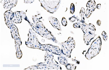 splicing factor 1 Mouse Monoclonal Antibody