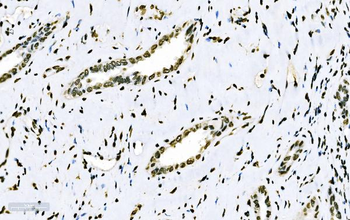 splicing factor 1 Mouse Monoclonal Antibody