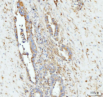 Grp75 Mouse Monoclonal Antibody