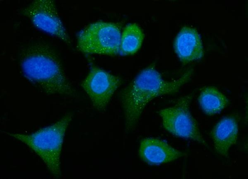 ALDH1A1 Mouse Monoclonal Antibody