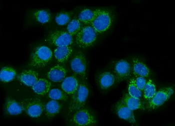 Glutaminase/GLS Mouse Monoclonal Antibody