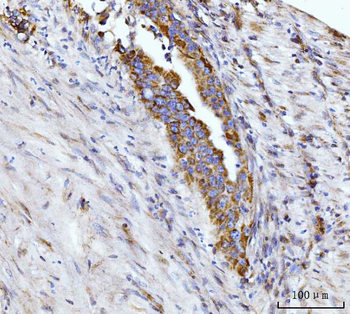 Glutaminase/GLS Mouse Monoclonal Antibody