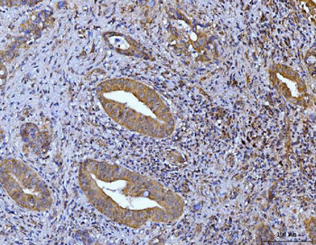 Glutaminase/GLS Mouse Monoclonal Antibody