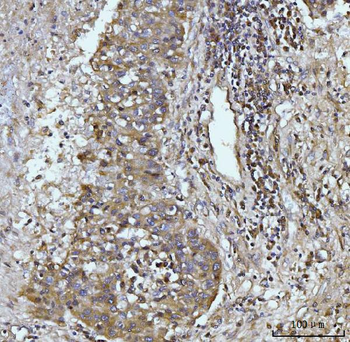 Glutaminase/GLS Mouse Monoclonal Antibody