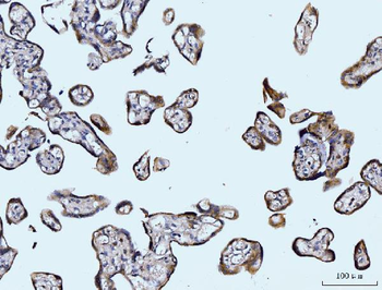 Glutaminase/GLS Mouse Monoclonal Antibody