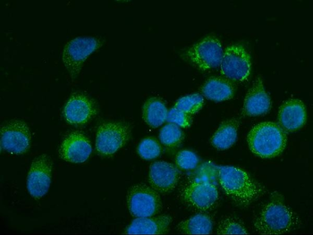 Glutaminase/GLS Mouse Monoclonal Antibody