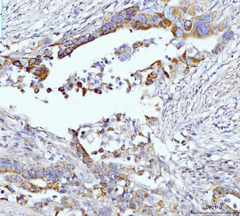 Glutaminase/GLS Mouse Monoclonal Antibody