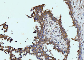 Glutaminase/GLS Mouse Monoclonal Antibody