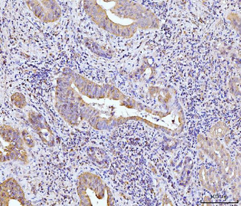 Glutaminase/GLS Mouse Monoclonal Antibody