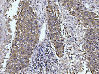 Glutaminase/GLS Mouse Monoclonal Antibody