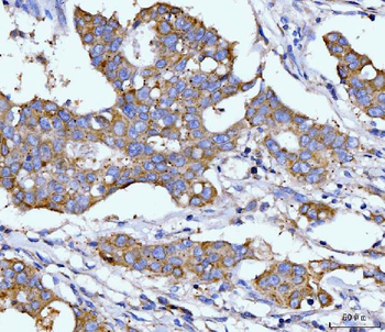 DHODH Mouse Monoclonal Antibody