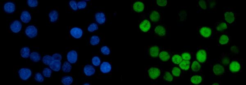 MCM6 Mouse Monoclonal Antibody