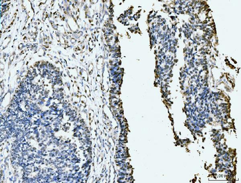 MCM6 Mouse Monoclonal Antibody