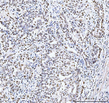 MCM6 Mouse Monoclonal Antibody