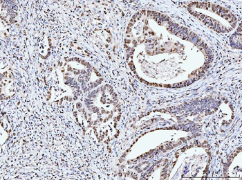 MCM6 Mouse Monoclonal Antibody