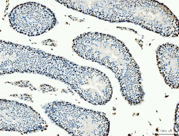 MCM6 Mouse Monoclonal Antibody
