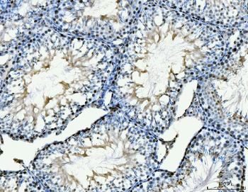 MCM6 Mouse Monoclonal Antibody