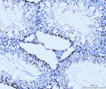 MCM6 Mouse Monoclonal Antibody