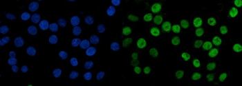 MCM6 Mouse Monoclonal Antibody