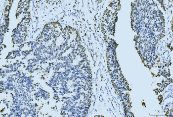 MCM6 Mouse Monoclonal Antibody