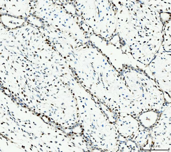 MCM6 Mouse Monoclonal Antibody