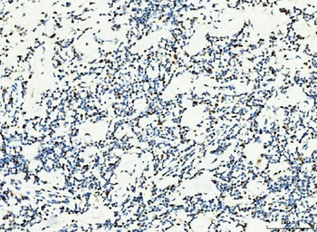 MCM6 Mouse Monoclonal Antibody