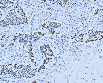MCM6 Mouse Monoclonal Antibody