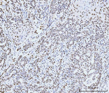 MCM6 Mouse Monoclonal Antibody