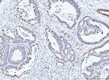 MCM6 Mouse Monoclonal Antibody