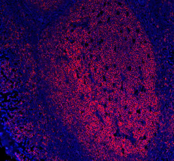 CD20/MS4A1 Mouse Monoclonal Antibody